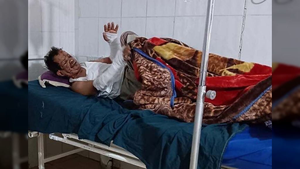إب... مليشيا الحوثي تتخلى عن علاج بائع الزلابيا وتقوم بملاحقة موثقي حادثة الاعتداء