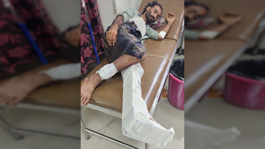 تعز... إصابة مدني برصاص قناص حوثي في مقبنة