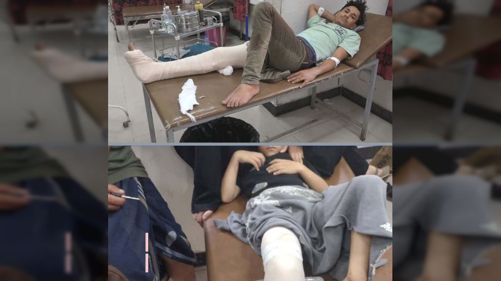 إصابة شخصين أحدهما طفل برصاص قناص حوثي أثناء جلبهما الماء في تعز