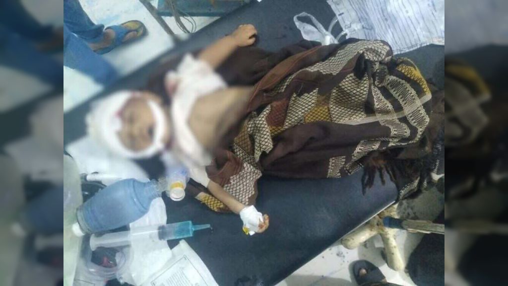 تعز... مقتل طفل رضيع بقصف لمليشيا الحوثي في إحدى قرى مقبنة