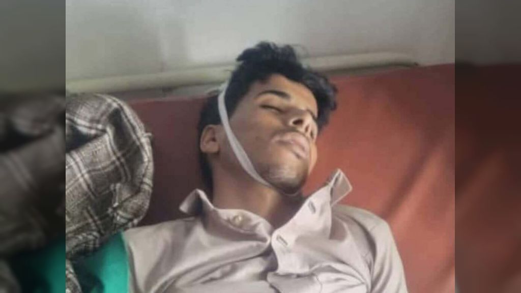 حجة - وفاة شاب داخل مقر أمني لمليشيا الحوثي