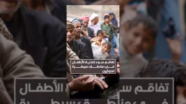 تفاقم أزمة سوء التغذية بين الأطفال في مناطق سيطرة الحوثيين