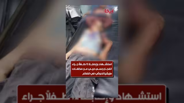 استشهاد 4 أطفال وإصابة آخرين جراء انفجار مقذوع في الضالع