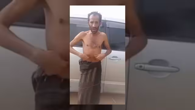 مواطن في إب يواجه الميليشيا بالاحتجاج على الجوع والانتهاكات