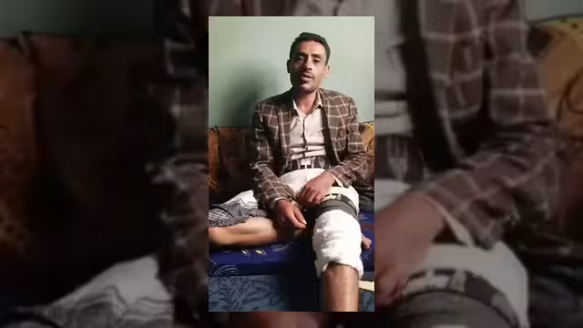 قاضٍ حوثي ينهب دراجة مواطن مصاب في حادث مروري بإب