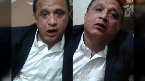 توحش حوثي وترهيب للمطالبين بالراتب