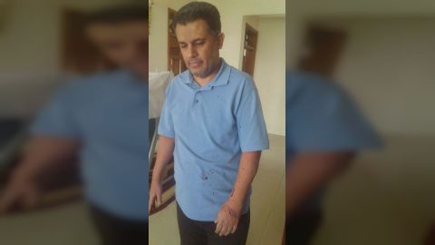 الأكاديمي المعارض للحوثيين إبراهيم الكبسي يتعرض للاعتداء في صنعاء وتدمير سيارته