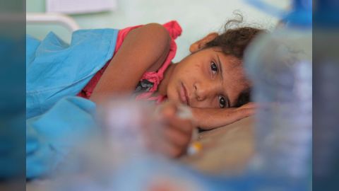 الصحة العالمية: مليونا طفل يمني دون سن الخامسة يعانون من الهُزال