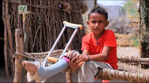 الأمريكي للعدالة: استمرار الحوثيين زراعة الألغام وعدم تسليم خرائطها سيؤدي إلى سقوط المزيد من الضحايا الأبرياء