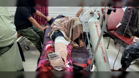 استشهاد شاب وإصابة آخر برصاص قناصة مليشيا الحوثي في تعز