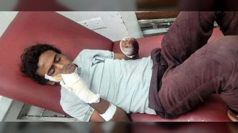 طفل في تعز يفقد يده بانفجار لغم حوثي