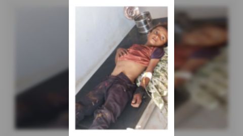 استشهاد طفل وإصابة 4 أطفال من أسرة واحدة في مجزرة حوثية جديدة بحق المدنيين في مقبنة غرب تعز