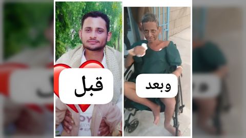 الضالع... وفاة أسير بعد أيام من إطلاق سراحه من سجون مليشيا الحوثي