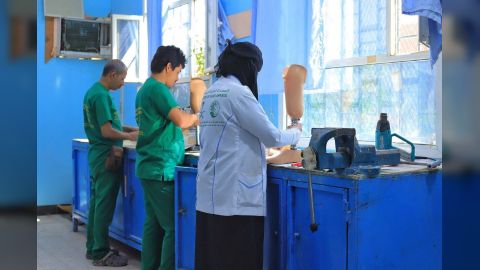 مركز الأطراف الصناعية بتعز يقدم خدماته لـ 2215 مستفيداً خلال الربع الأول من 2025