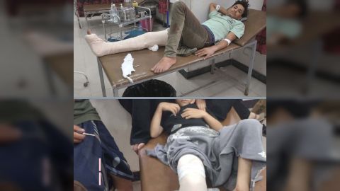 إصابة شخصين أحدهما طفل برصاص قناص حوثي أثناء جلبهما الماء في تعز