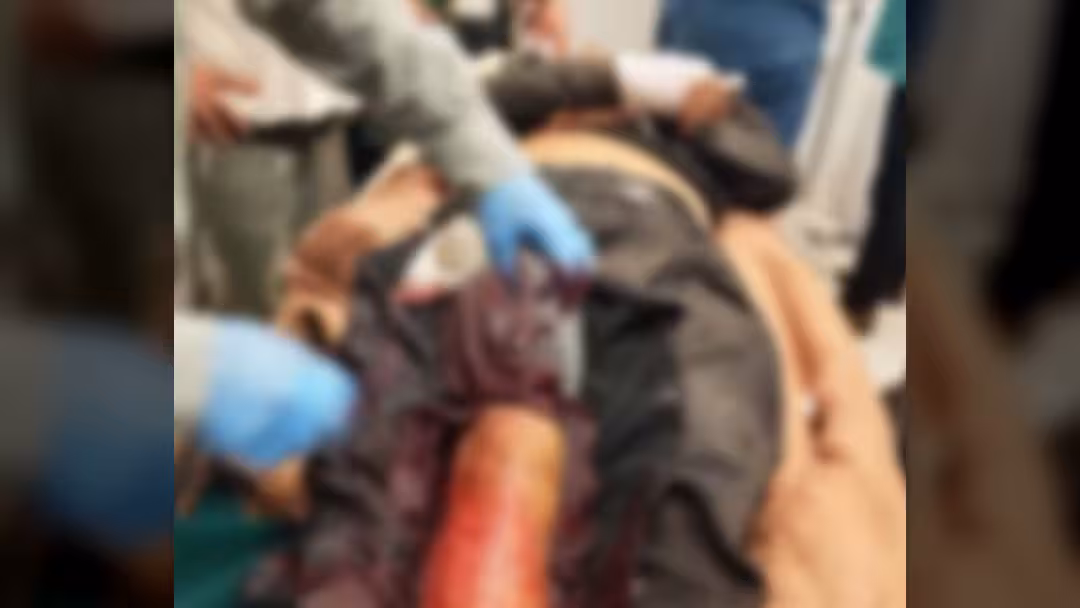 استشهاد مدني برصاص قنّاص حوثي شرق مدينة تعز