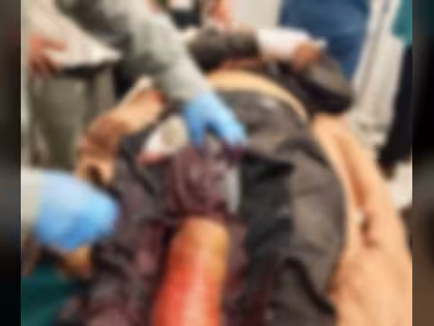 استشهاد مدني برصاص قنّاص حوثي شرق مدينة تعز