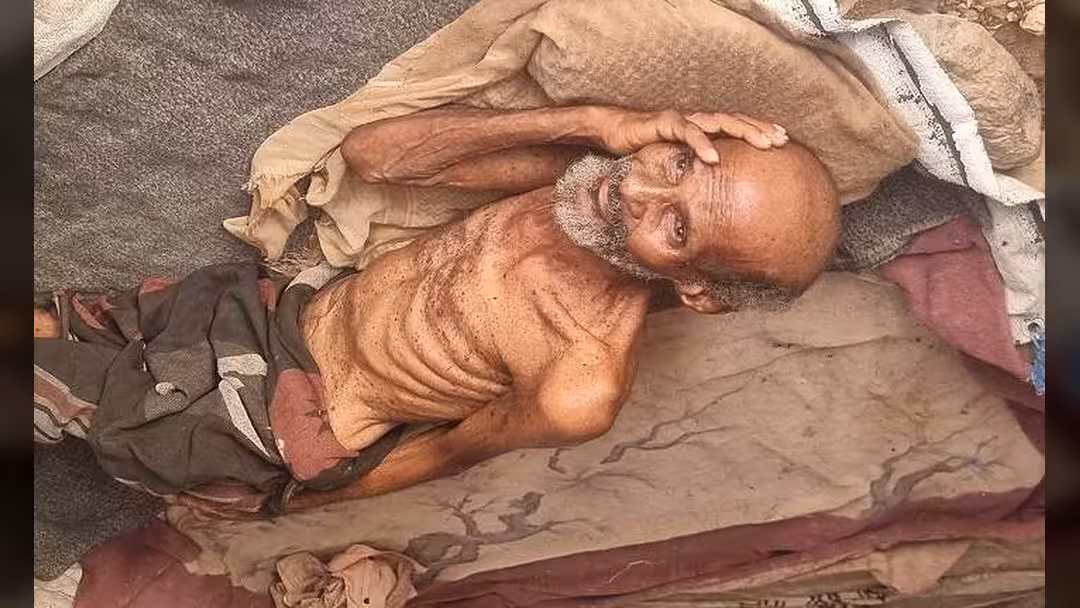 وفاة مُسن نتيجة الجوع في مخيمات النزوح بمحافظة حجة